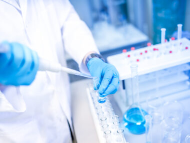 SurVaxM vaccine in myeloma patients