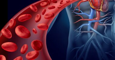 Stem cell transplants