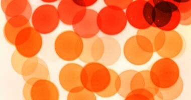 Large-scale study of myeloma precursor