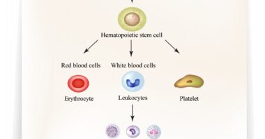 stem cell transplant therapy