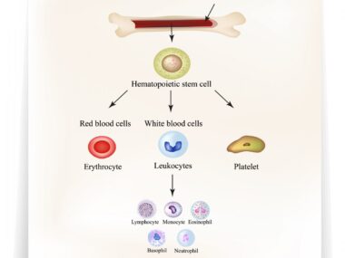 stem cell transplant therapy