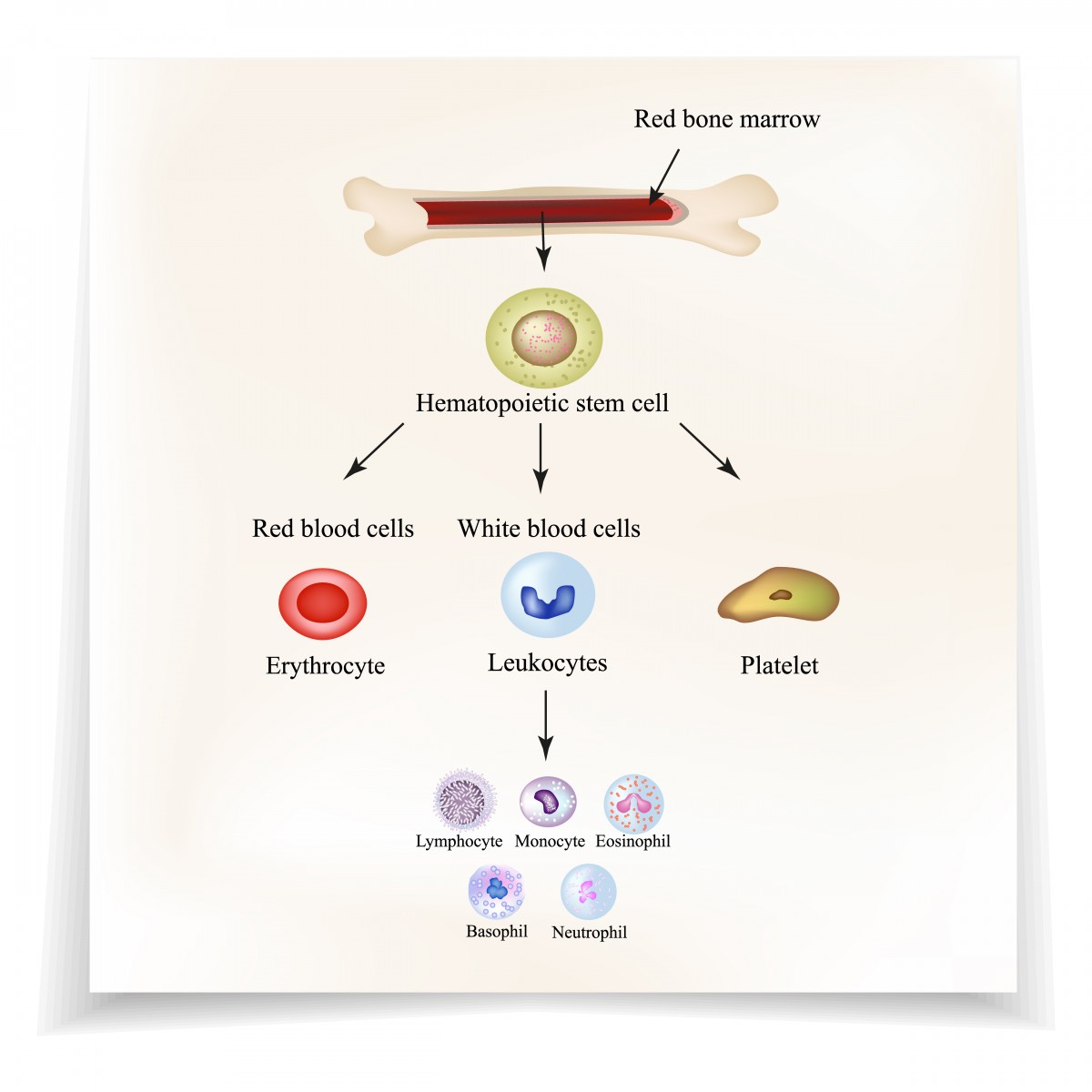 stem cell transplant therapy