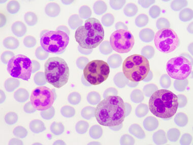 elotzumab combo can help prolong progression free RRMM