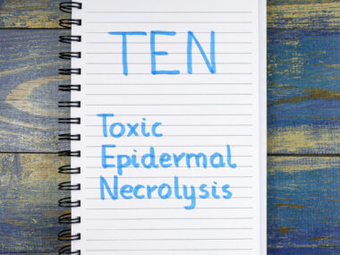 toxic epidermal necrolysis