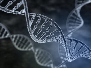 RNA editing, multiple myeloma
