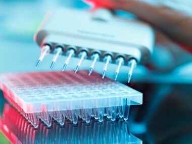 myeloma diagnosis, blood tests