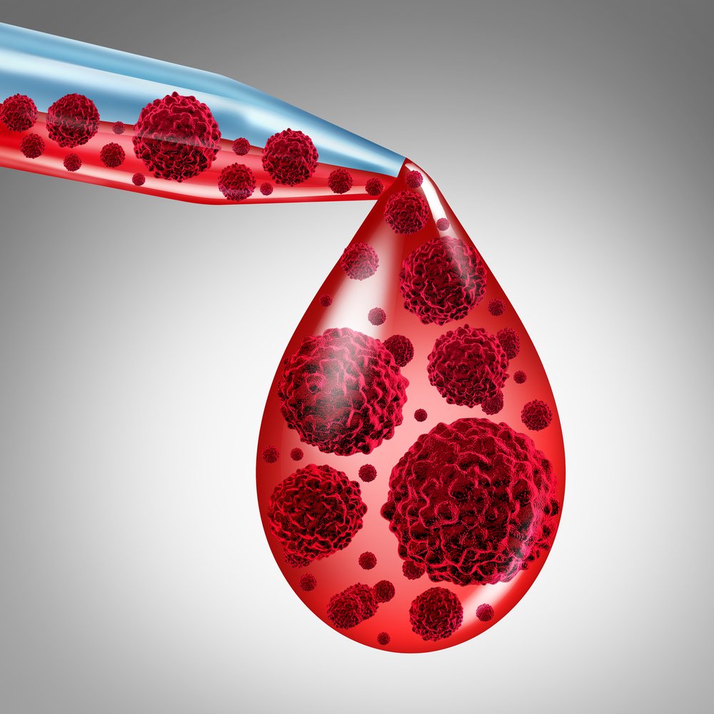 stem cell transplant, PNK-007, myeloma