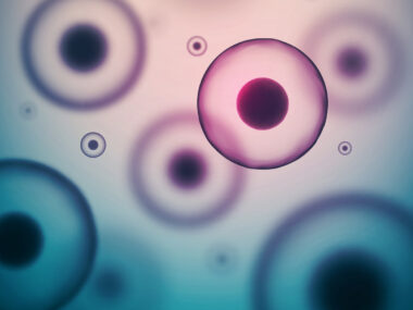 Cellectis and UCARTCS1