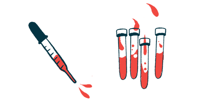 An illustration of blood samples to go through laboratory testing.