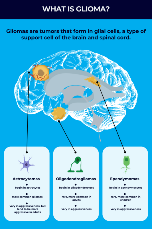 What is glioma infographic