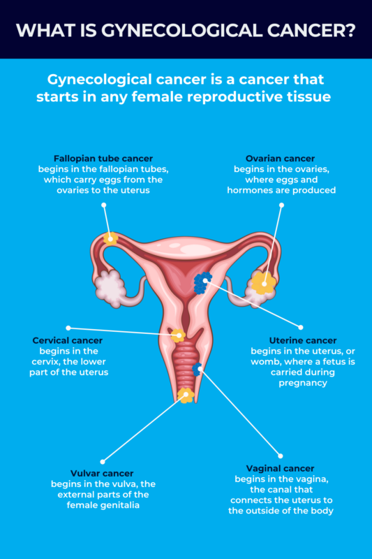 Gynecological cancer infographic