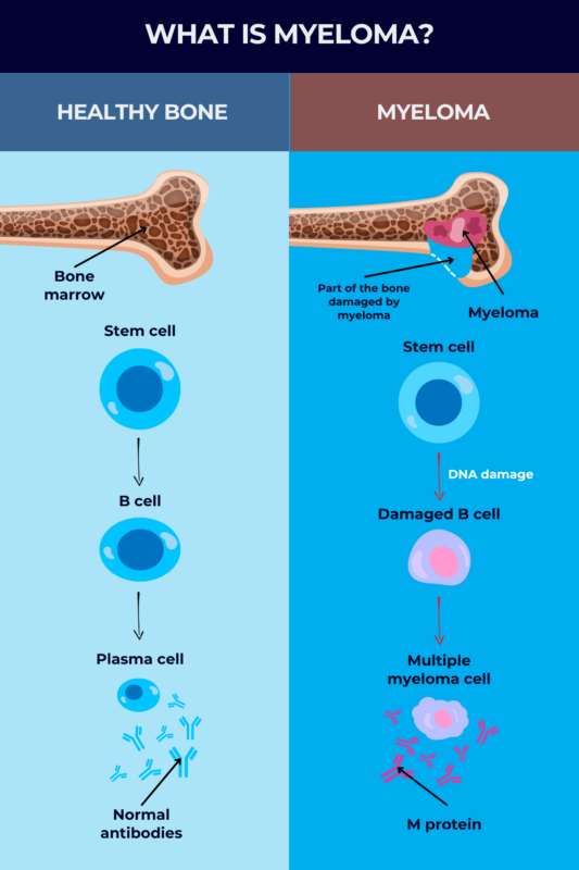 Infographic explaining what myeloma is