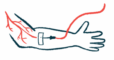 An intravenous, or into-the-vein, infusion is adminstered into a patient's right forearm.