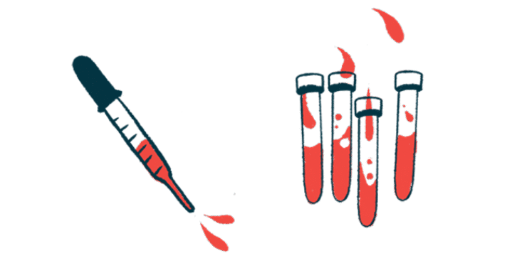 A dropper hovers beside several vials of blood.