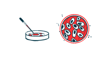 An eyedropper and a petri dish, with an aerial view of the petri dish showing growing cells.