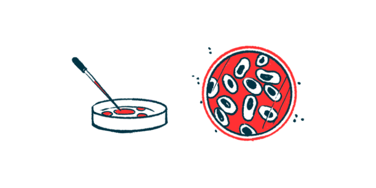 An eyedropper and a petri dish, with an aerial view of the petri dish showing growing cells.