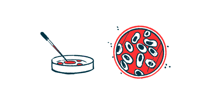 An eyedropper and a petri dish, with an aerial view of the petri dish showing growing cells.