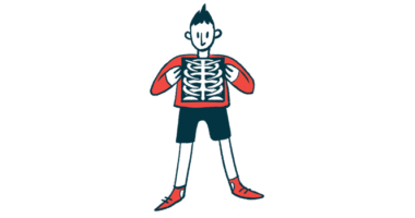 Illustration of a person holding an X-ray image showing the ribs and upper torso.