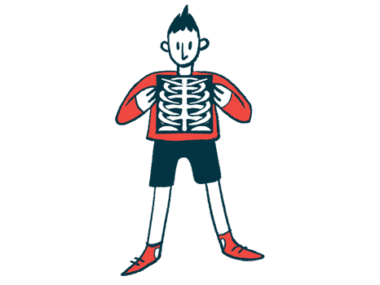 Illustration of a person holding an X-ray image showing the ribs and upper torso.