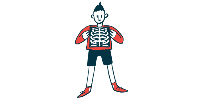 Illustration of a person holding an X-ray image showing the ribs and upper torso.